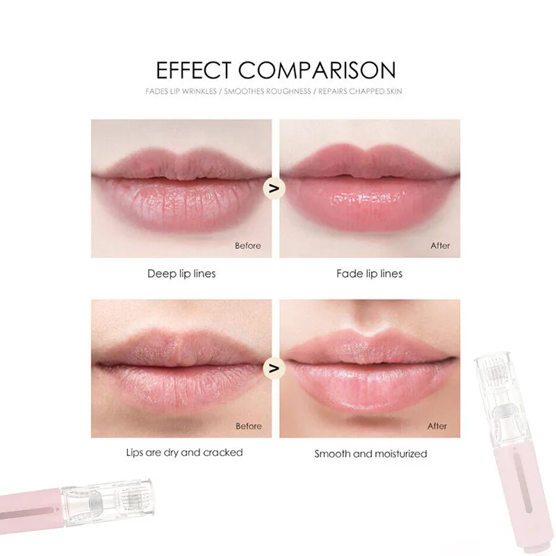 Microneedle Lip Glow Kit